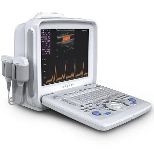 Portable Color Doppler Ultrasonic System — view 2