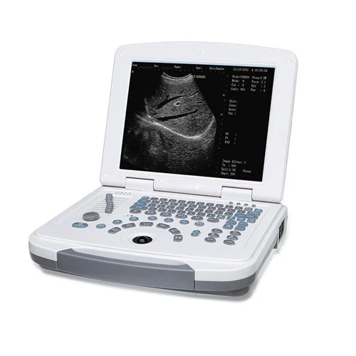 Full Digital Laptop Ultrasound Scanner — view 2